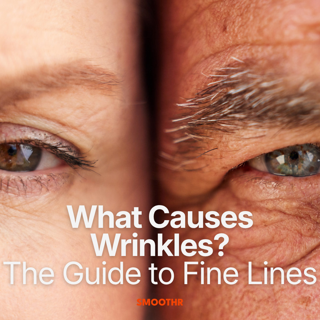 What Causes Wrinkles? Your Complete Guide to Fine Lines (And How to Soften Them)